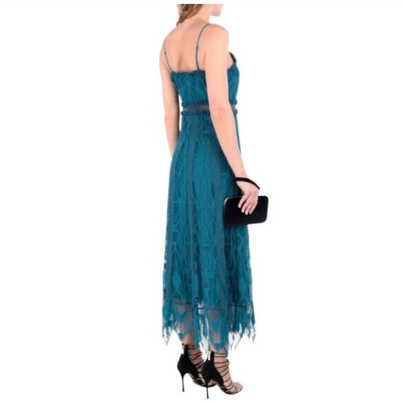 NEW Foxiedox Gloria Lace Tea Length Dress in Teal Anthropologie FA979DR - Picture 2 of 13